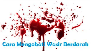 Illustration for article titled Cara menyembuhkan ambeien wasir atau BAB mengeluarkan darah segar